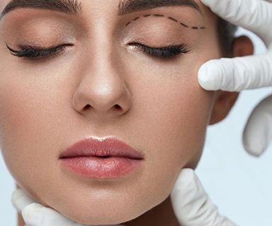 Blépharoplastie