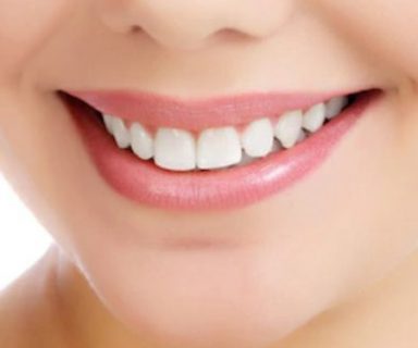 Chirurgie des maxillaires