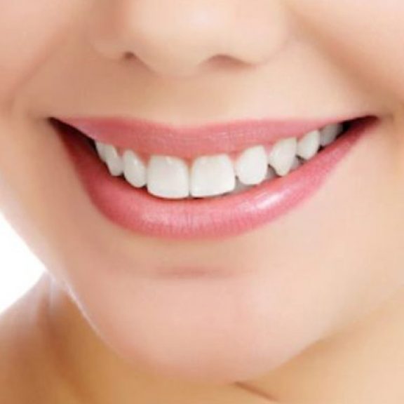 Chirurgie des maxillaires
