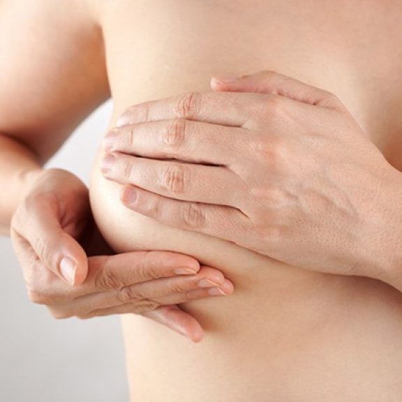 Lifting des seins Avec ou sans prothèses