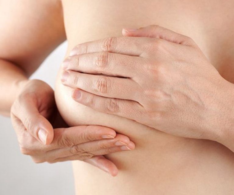 Lifting des seins Avec ou sans prothèses