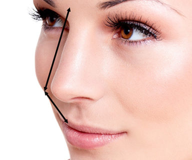 Rhinoplastie